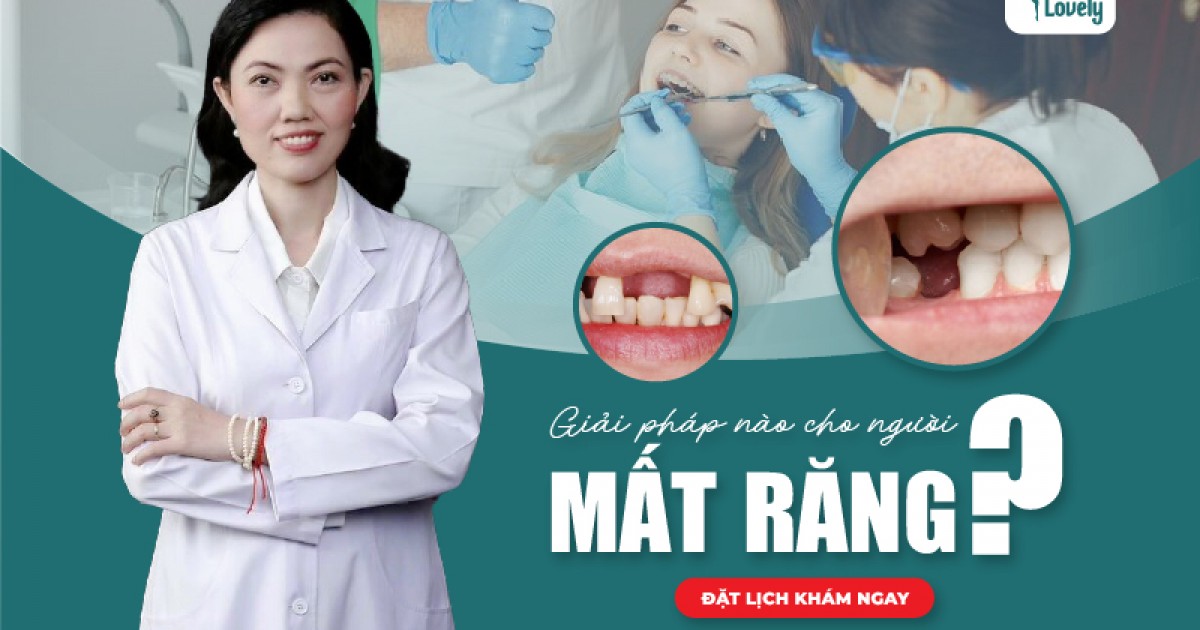 Nha Khoa Lovely - Quận 1 - Giải pháp nào cho người mất răng?