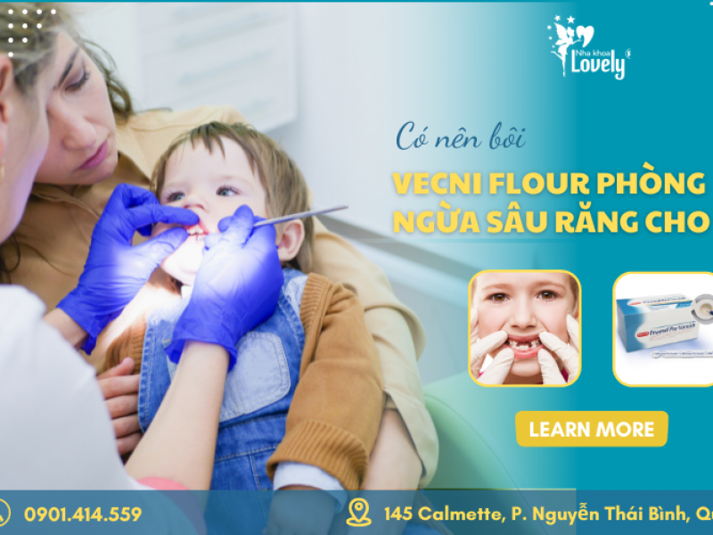 Có nên bôi Vecni Flour phòng ngừa sâu răng cho trẻ?
